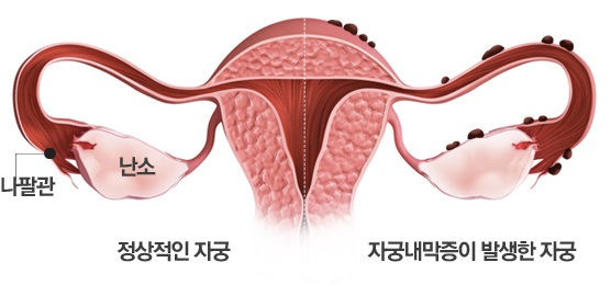 자연임신준비